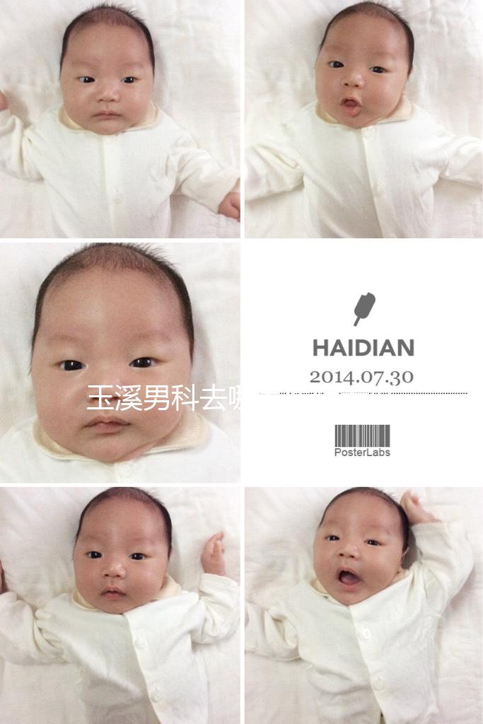 玉溪男科去哪家醫院看好，怎么選攻略，這個排行榜不要錯過