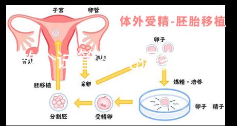 做個(gè)試管嬰兒得多少錢(qián)