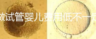 做試管嬰兒費用低不一定好!在江蘇只有29家醫(yī)院有資質(zhì)