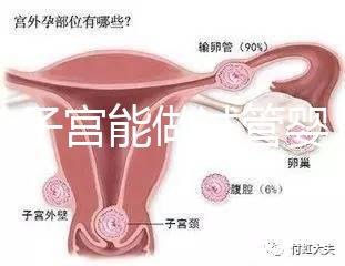 雙角子宮能做試管嬰兒嗎？可以，但這2大條件缺一不可