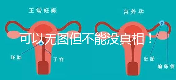 可以無圖但不能沒真相！段濤大夫帶你了解B超檢查報告單