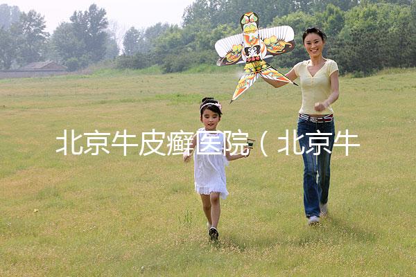 北京牛皮癬醫(yī)院（北京牛皮癬醫(yī)院排名）