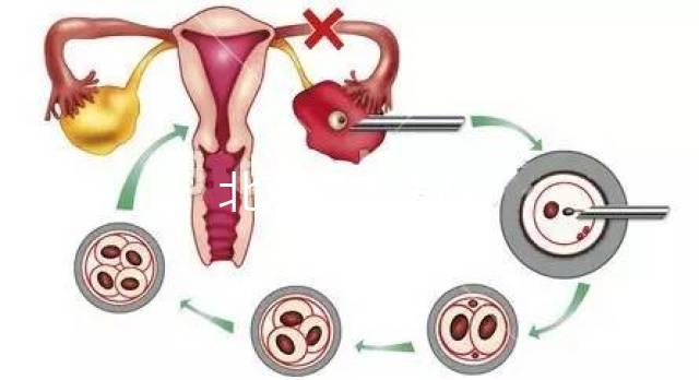 北京濕疣醫(yī)院