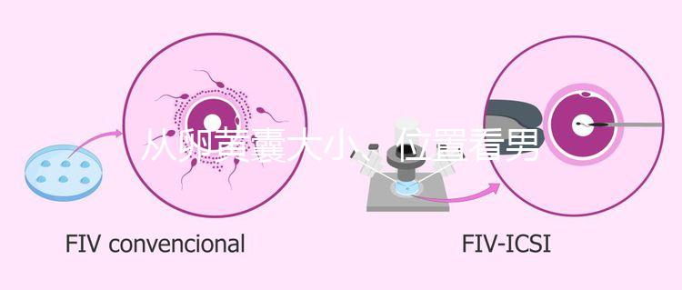 從卵黃囊大小、位置看男女，寶寶性別分辨一眼就準