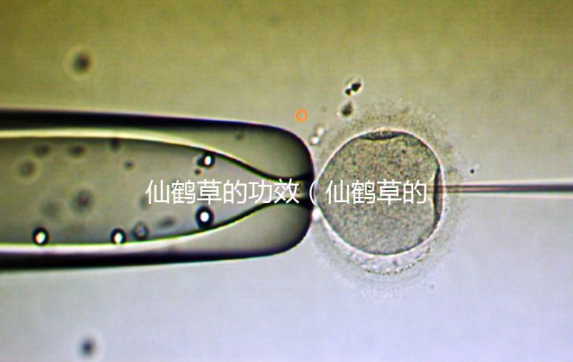 仙鶴草的功效(仙鶴草的功效與作用)