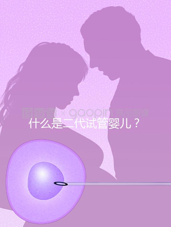 什么是二代試管嬰兒？