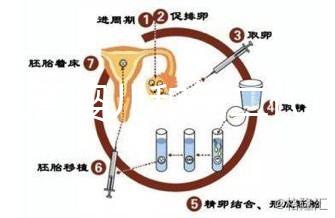 代試管嬰兒和第二代試管嬰兒的區(qū)別，基因篩查技術(shù)！
