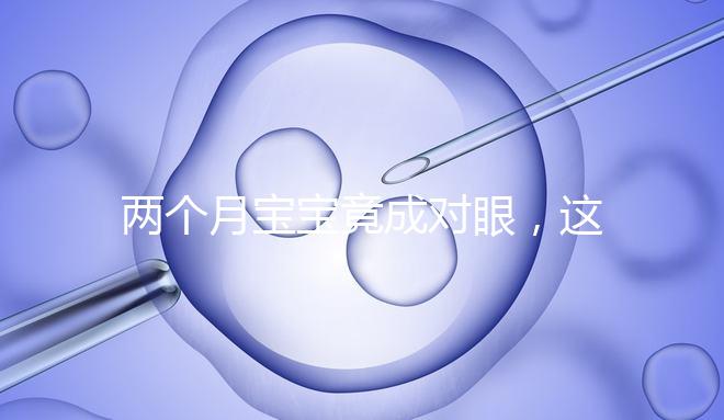 兩個(gè)月寶寶竟成對(duì)眼，這5大形成原因家長(zhǎng)必知