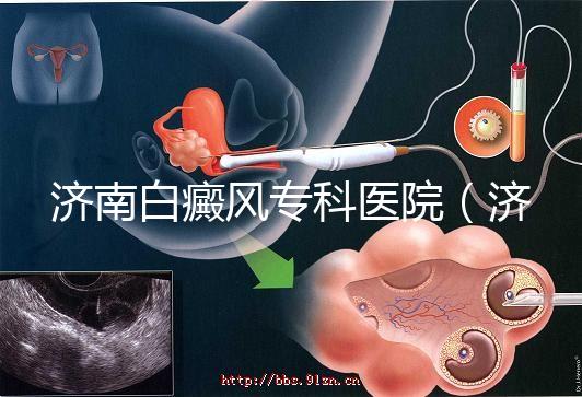 濟(jì)南白癜風(fēng)?？漆t(yī)院（濟(jì)南白點癲風(fēng)醫(yī)院排名）