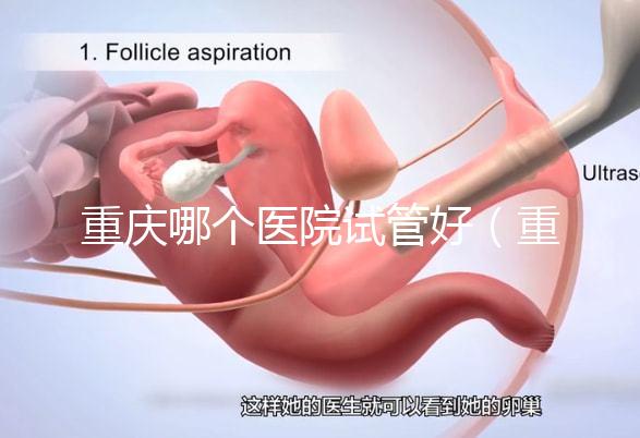 重慶哪個醫(yī)院試管好（重慶哪個醫(yī)院試管好一點）