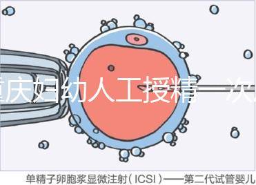 重慶婦幼人工授精一次成功率揭秘，移植費(fèi)用貴有原因