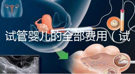 試管嬰兒的全部費用(試管嬰兒的全部費用大概是多少重慶安琪兒電話)