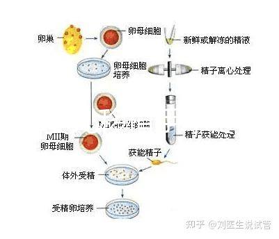 試管嬰兒移植手術(shù)疼嗎(試管失敗第二次收費嗎)