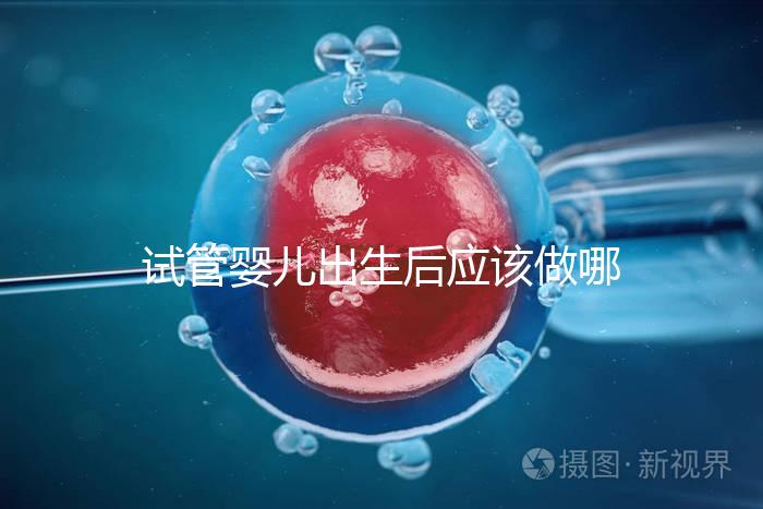 試管嬰兒出生后應(yīng)該做哪些檢查答案？DR應(yīng)該看情況嗎？