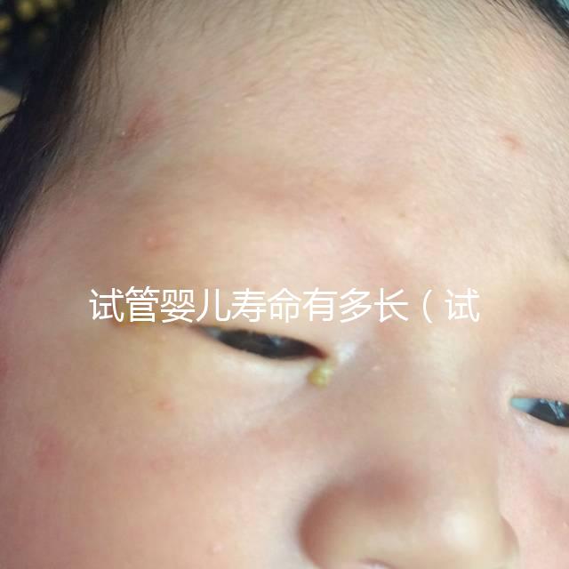 試管嬰兒壽命有多長（試管嬰兒壽命有多長時間）