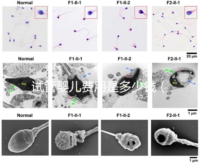 試管嬰兒費(fèi)用是多少錢(試管嬰兒費(fèi)用是多少錢一次)