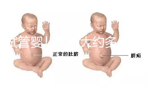 試管嬰兒費(fèi)用大約多少2021（試管嬰兒費(fèi)用大約多少2021年鄭州）