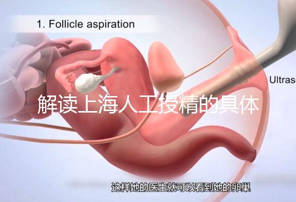解讀上海人工授精的具體過程，會不會痛看醫(yī)生怎么說？