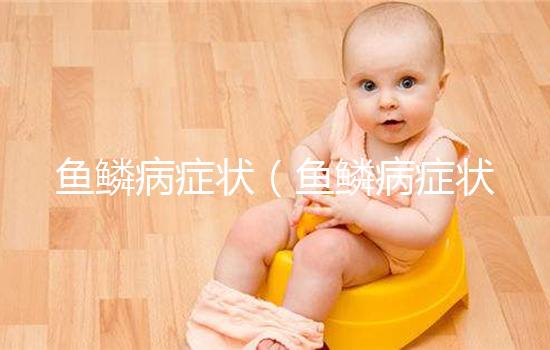 魚鱗病癥狀(魚鱗病癥狀及表現(xiàn))