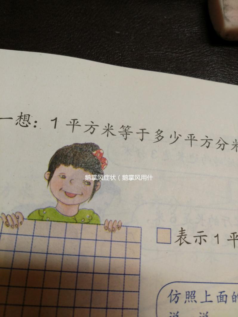 鵝掌風癥狀(鵝掌風用什么藥根治)