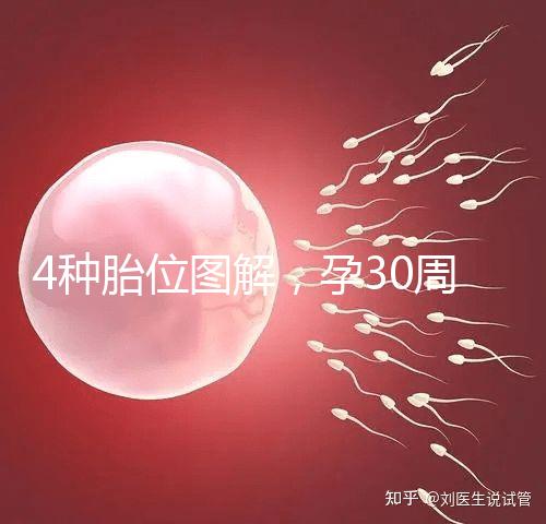 4種胎位圖解，孕30周這個姿勢最適合順產