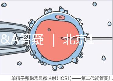 Q&A答疑 ｜ 北京16項輔助生殖技術(shù)進(jìn)醫(yī)保，試管可以報銷嗎？