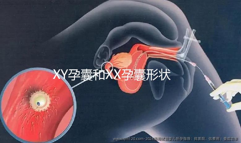 XY孕囊和XX孕囊形狀各有差異，橢圓形可能是懷女哦！